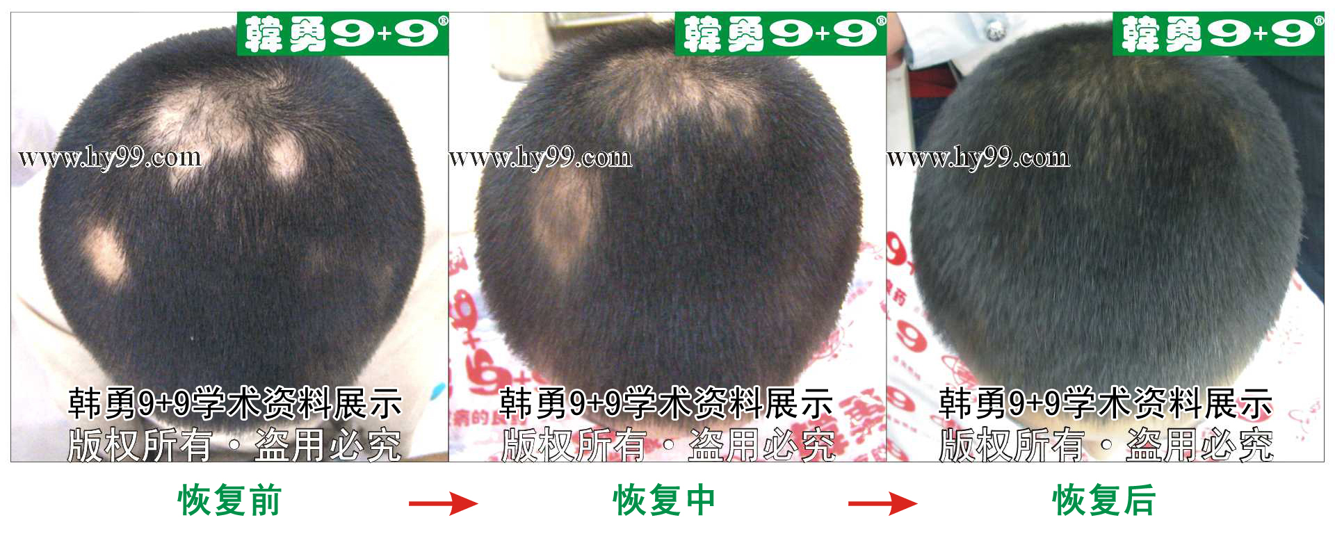 0001 HD_bantu bj104-9(1).jpg