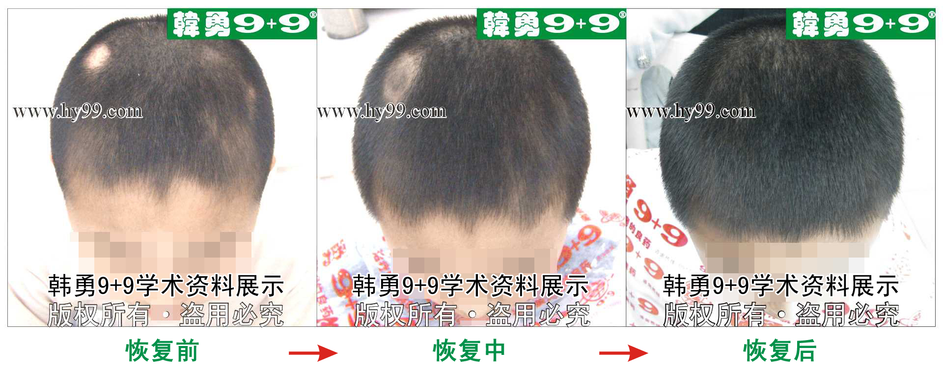 0001 HD_bantu bj104-9(2).jpg