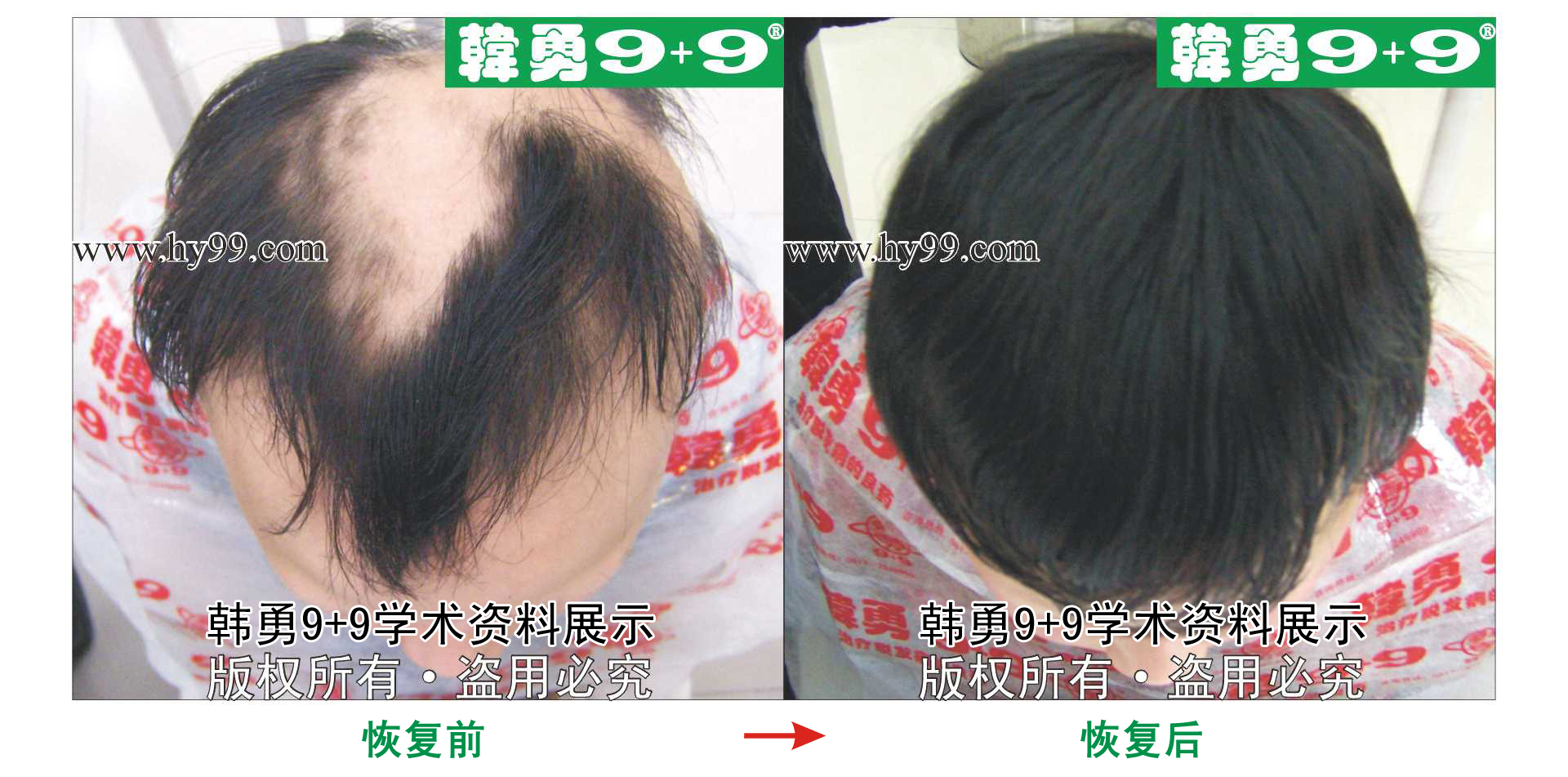 0003 HD_bantu bj105-39(1).jpg