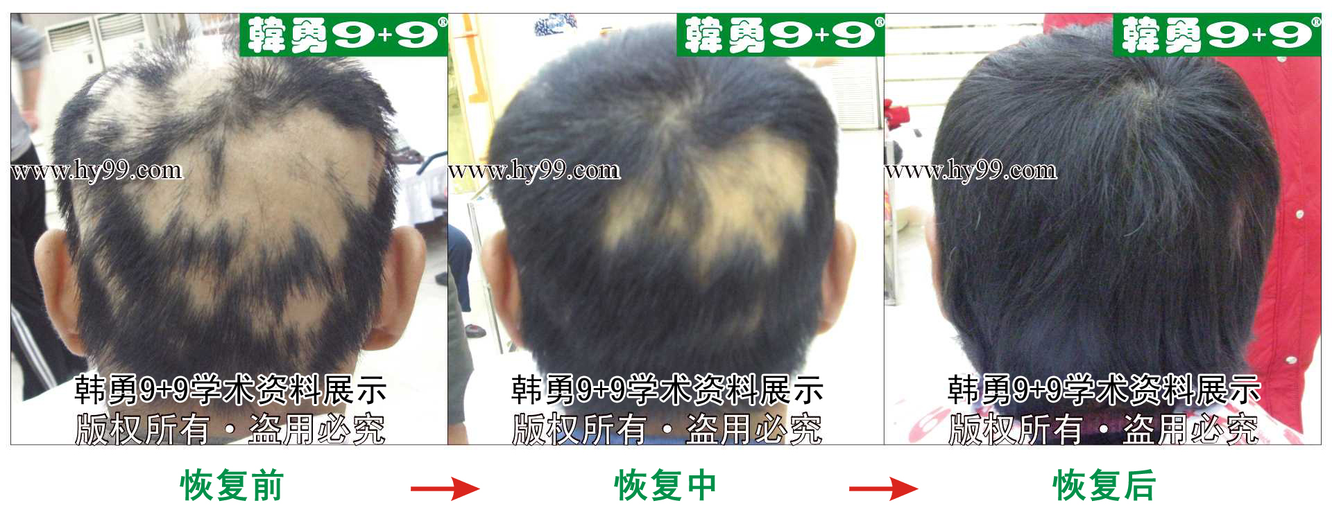 0007 HD_bantu bj107-67(1)b.jpg