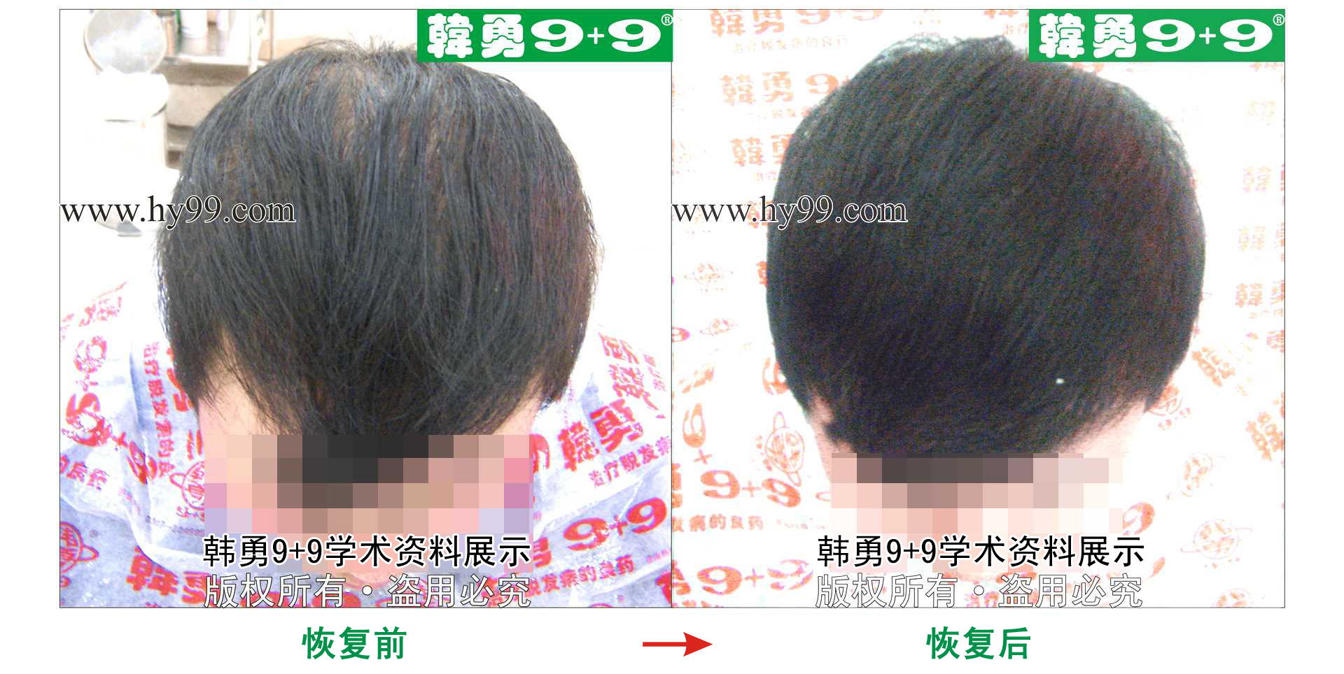 0010 HD_zhiyixing bj115-46.jpg