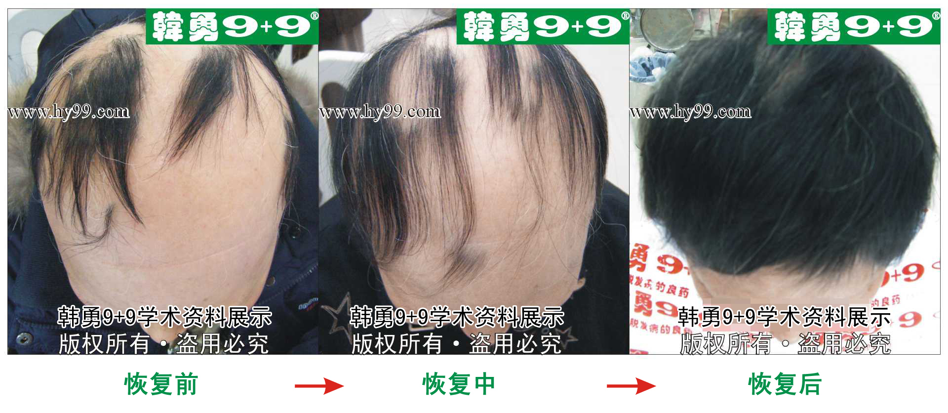 0011 HD_bantu bj115-19(1)a.jpg