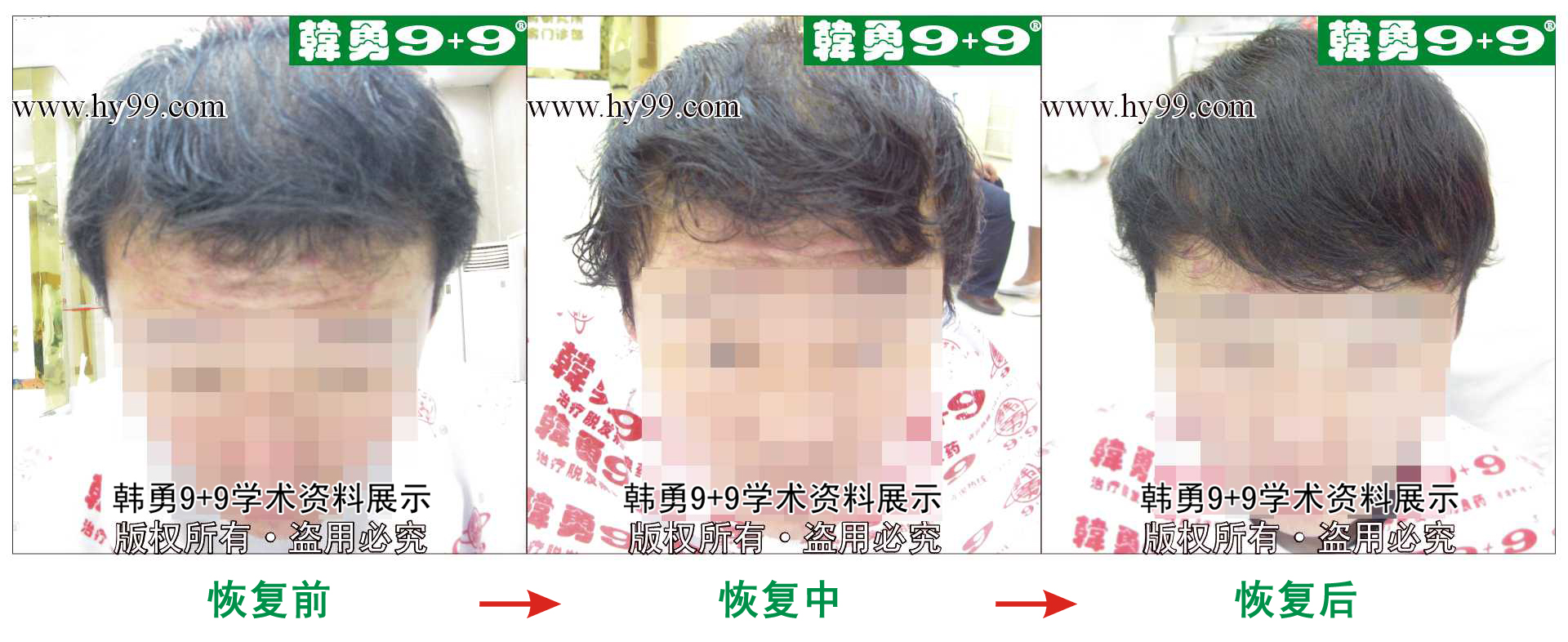 0016 HD_zhiyixing bj149-4b.jpg