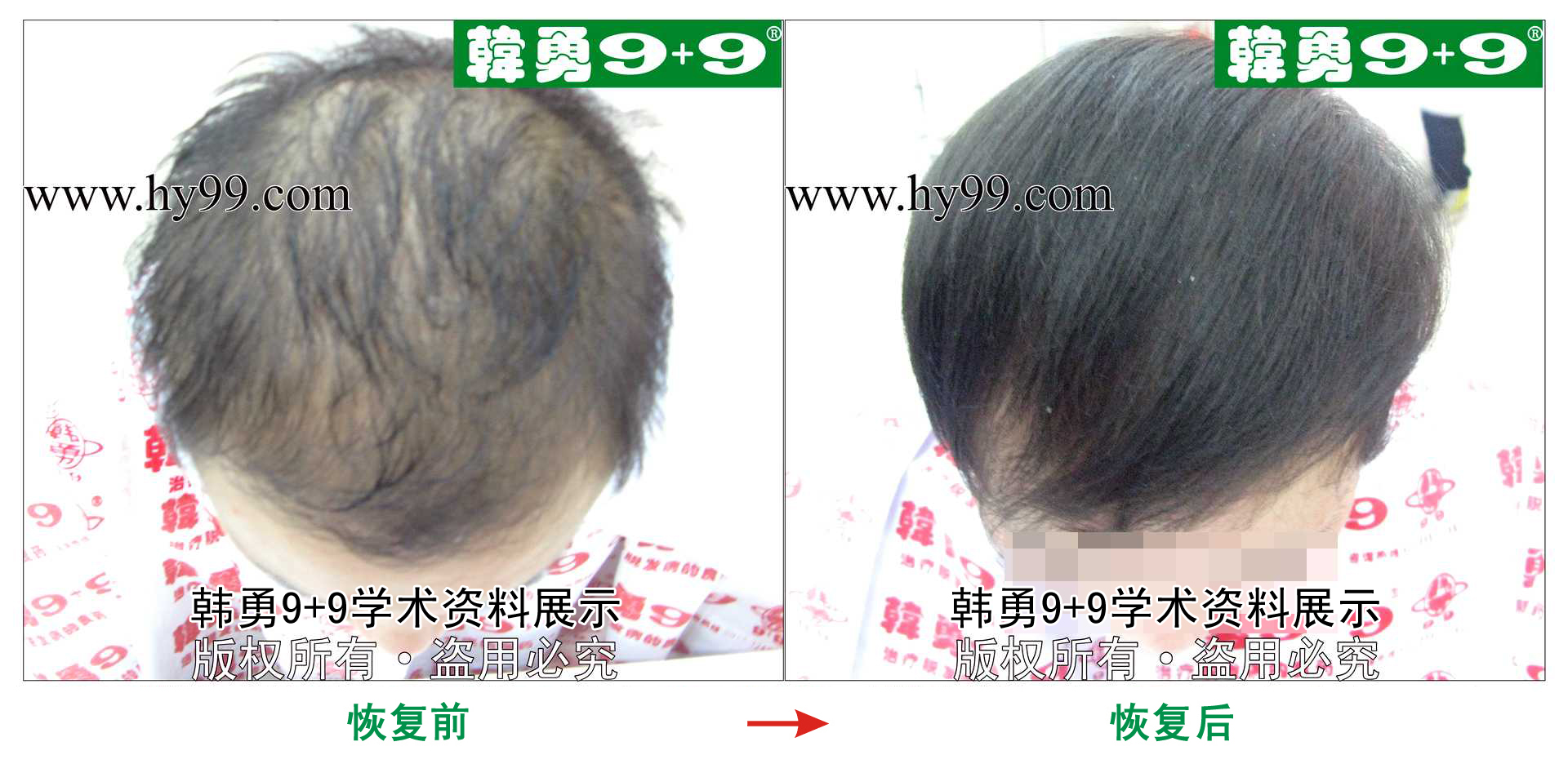 0020 HD_zhiyixing bj155-17a.jpg