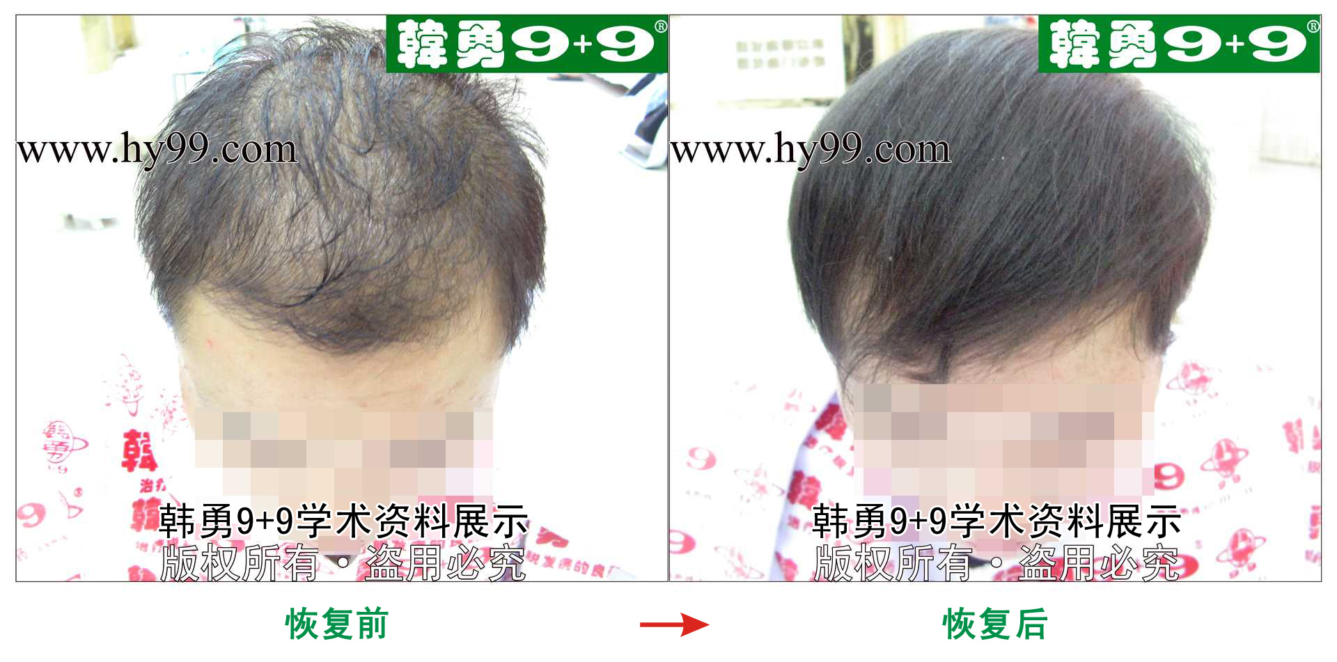 0020 HD_zhiyixing bj155-17b.jpg