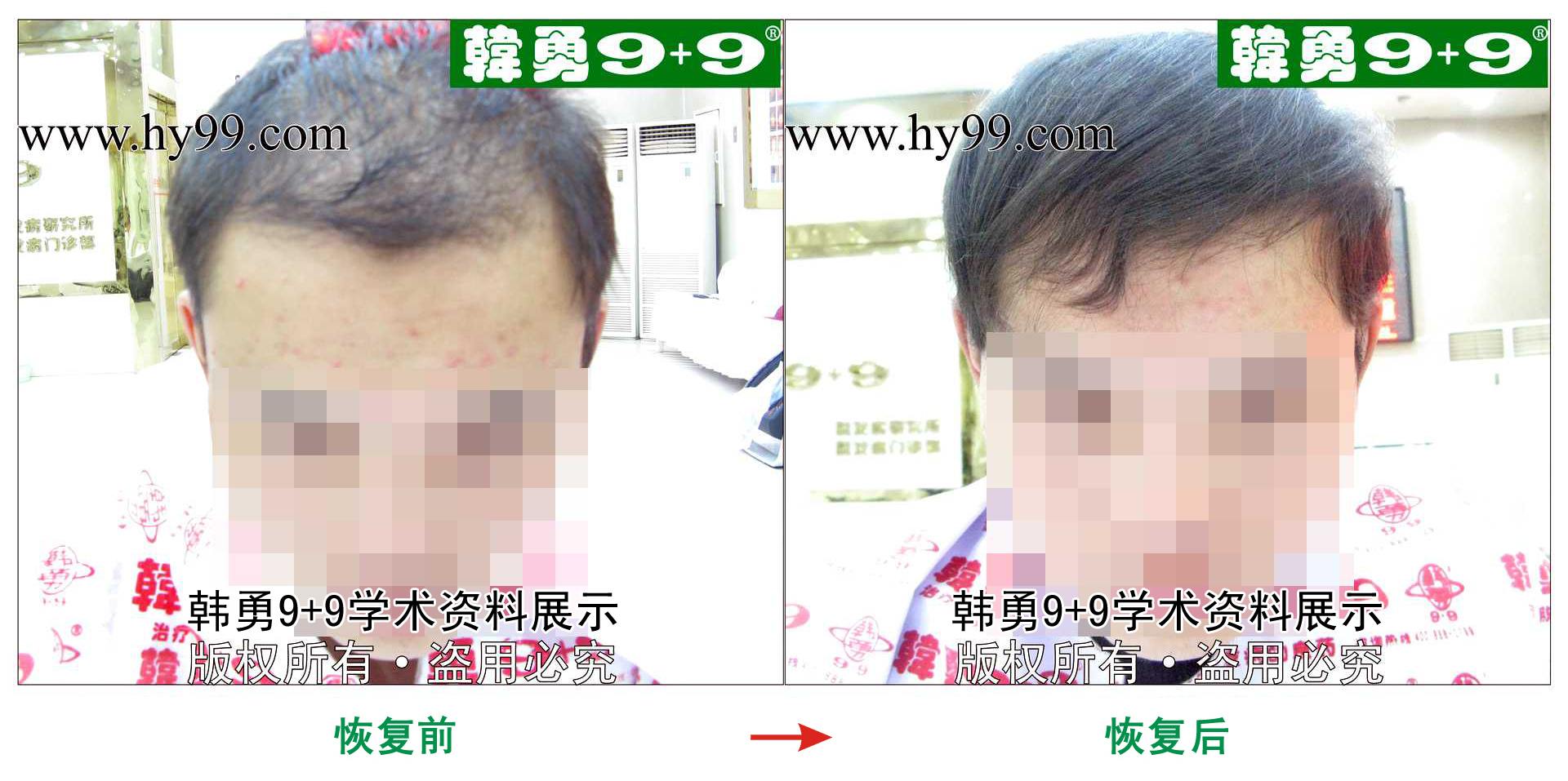 0020 HD_zhiyixing bj155-17c.jpg