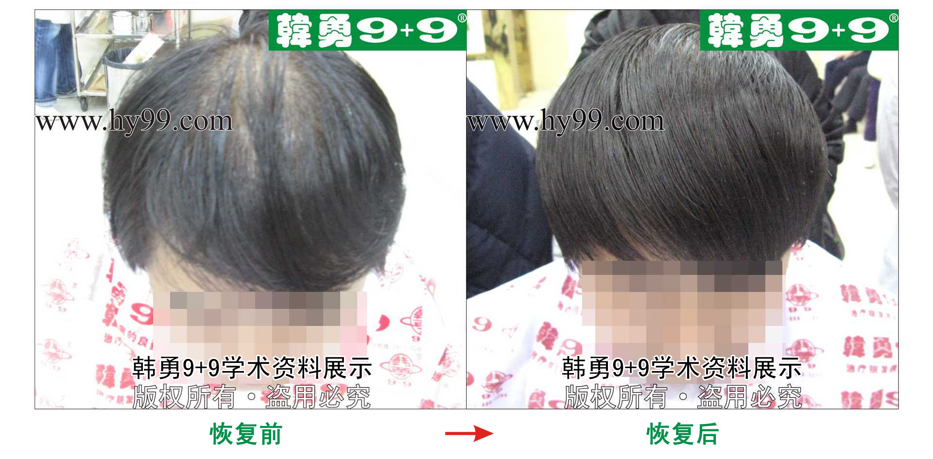 0024 HD_zhiyixing bj167-15b.jpg