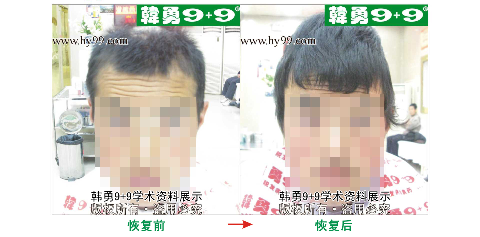 0043 HD_bantu bj151-7(2).jpg