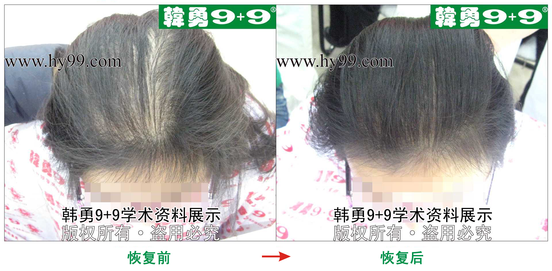 0026 HD_zhiyixing bj176-2a.jpg