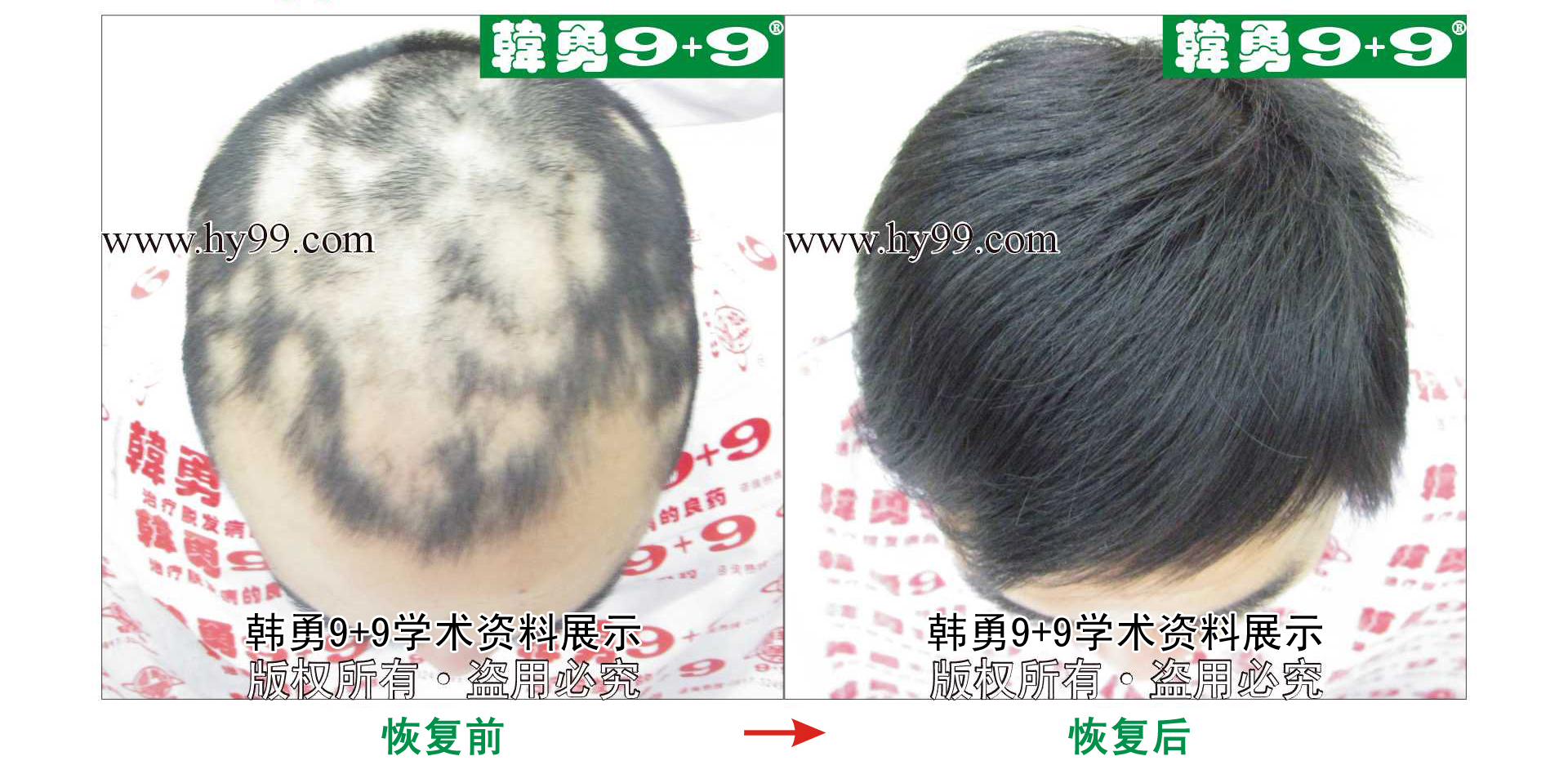 0031 HD_bantu bj143-68(1)a.jpg