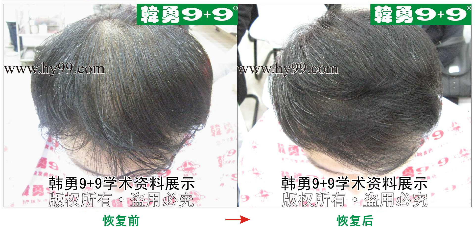 0032 HD_zhiyixing bj200-20a.jpg