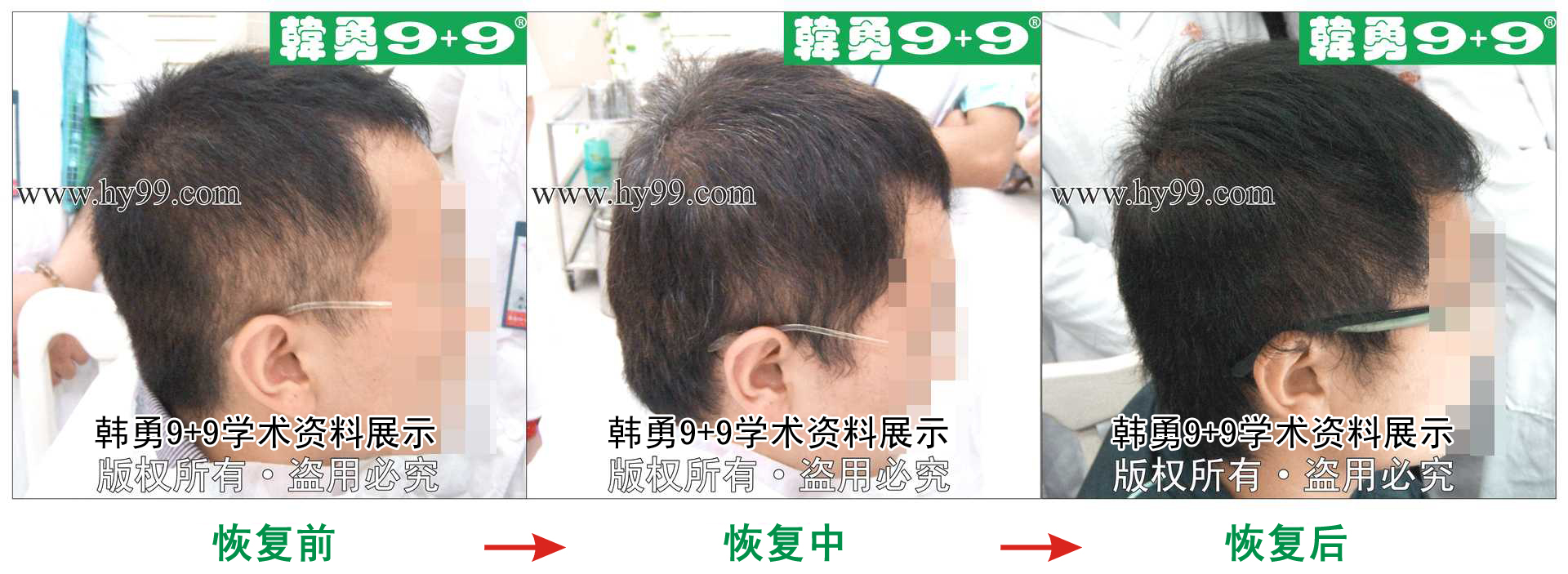 0034 HD_zhiyixing bj994-3b.jpg