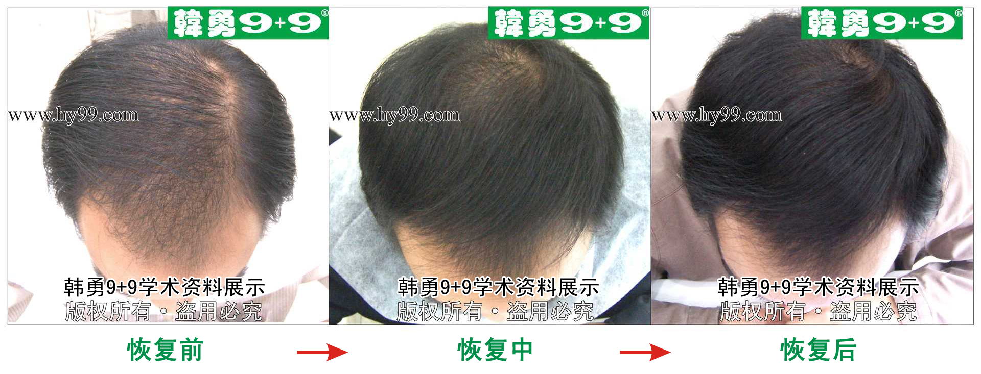 0036 HD_zhiyixing bj996-12a.jpg