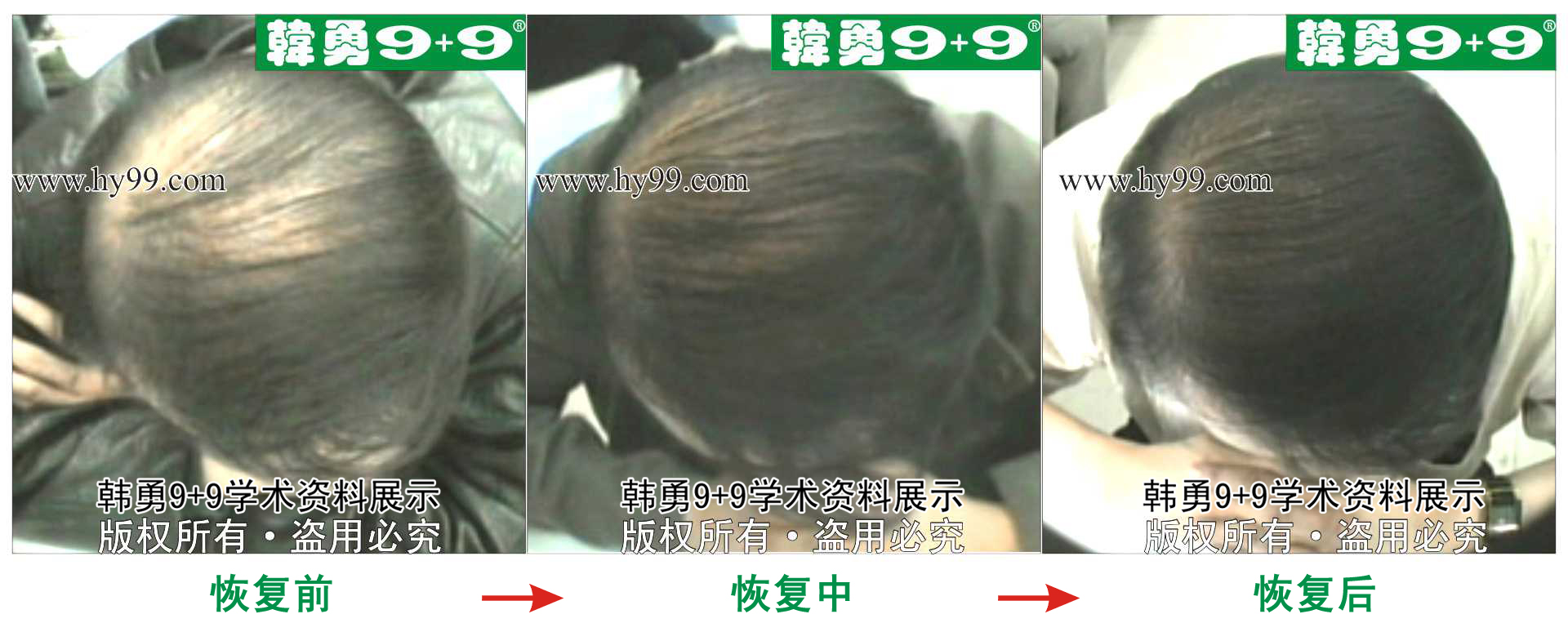 0040 HD_zhiyixing xa6-36.jpg